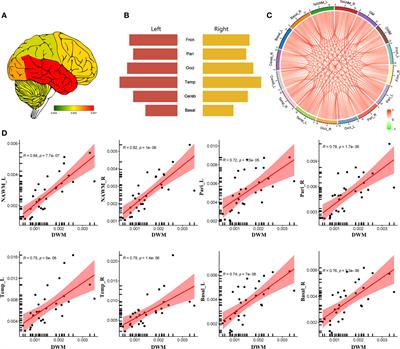 Characteristics of cerebral blood flow in an Eastern sample of multiple sclerosis patients: A potential quantitative imaging marker associated with disease severity